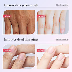 Crème pour les mains blanchissante à l'acide hyaluronique double tube SADOER Rose, hydratation intense, anti-âge, absorption rapide, soin <span class=keywords><strong>d</strong></span>'hiver - Product Image 5