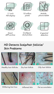 Microscopio Capilar Portátil con Detector Digital para Uso Doméstico, Pruebas de Crecimiento del Cabello, Diseño Compacto, Precio de Fábrica - Product Image 2
