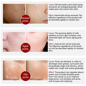 Essence Raffinante aux Pores de Niacinamide : Réduit les Pores, Contrôle le Sébum, Éclaircit, Élimine les Points Noirs, Hydratation Profonde, Lisse la Peau, Extrait de Saule - Product Image 6