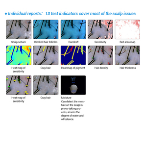 เครื่องวิเคราะห์หนังศีรษะและเส้นผมอัจฉริยะ T5 AI รุ่นให<span class=keywords><strong>ม</strong></span>่ พร้อ<span class=keywords><strong>ม</strong></span>ระบบวิเคราะห์ 8 <span class=keywords><strong>ภาษา</strong></span> - Product Image 3