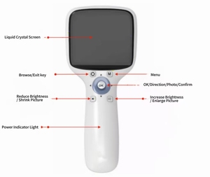 Máy ảnh võng mạc cầm tay thông minh BM-FC-01 Thiết bị chẩn đoán nhãn khoa và võng mạc thú y - Product Image 4