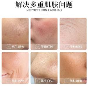 <span class=keywords><strong>Appareil</strong></span> de beauté Hydra Facial Jet Peel Diamant Oxygène 17 en 1 Hydra Dermabrasion <span class=keywords><strong>Appareil</strong></span> Facial H2O2 Aqua Machine Régénération de la peau - Product Image 6