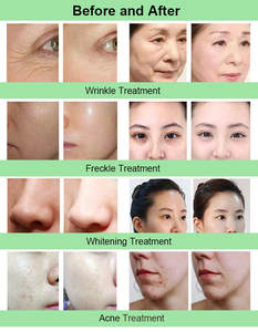 Bonne qualité <span class=keywords><strong>nettoyage</strong></span> en profondeur visage 4 pièces bouteilles conception diamant épurateur Jet <span class=keywords><strong>nettoyage</strong></span> du visage Peel 8 en 1 Hydra Dermabrasion Machine - Product Image 5