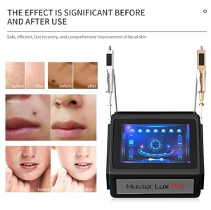2024 the Latest All-in-one Efficient Acne <strong>Exfoliating</strong> Home <strong>Facial</strong> Care Beauty <strong>Tool</strong> - Product Image 4
