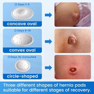 Cinturón de Soporte para Hernia Umbilical Ajustable para Bebés, Recién Nacidos, Cinturón Abdominal para Hernia Umbilical - Product Image 5