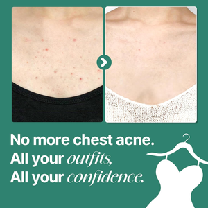 Gel de Baño Exfoliante Diario de 400 ml con Árbol de Té y Ácido Salicílico para el Acné, AHA BHA PHA, Limpiador Corporal Milagroso para Eliminar el Acné en 30 Días - Product Image 4