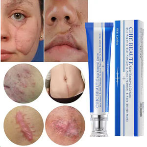 Gel Reparador de Piel Herbal, Rápido y Efectivo, Loción para Eliminar Estrías y Cicatrices, Crema Natural para Marcas de Acné y Granos - Product Image 6