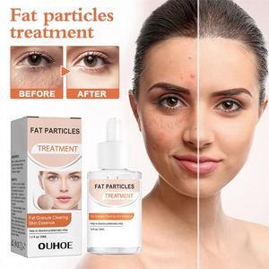 OUHOE - Esencia Facial de 30 ml para Eliminar Grasa y Granos, Tratamiento para Erupciones Cutáneas, Papules y Pústulas, Suero Facial - Product Image 1