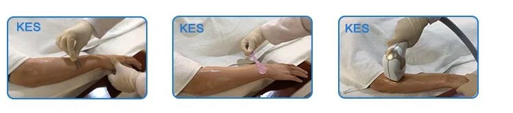 Triple Wave 755 808 1064nm Laser sopran Titanium Diode Lazer Laser Hair Removal