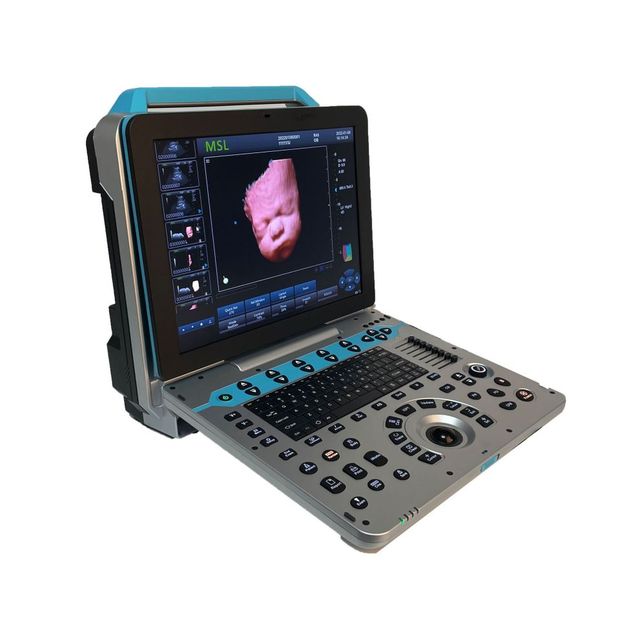 Portable Ultrasound Machine Dawei Medical Abdomen Gynecology Neonatal Diagnostic Ultrasound Machine 4D 5D Trolley Color Doppler