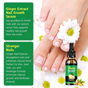 Aceite para el cuidado de las cutículas de jengibre vegetal natural de primera calidad, tratamientos de uñas a base de hierbas para fortalecer las uñas y promover el crecimiento - Product Image 4