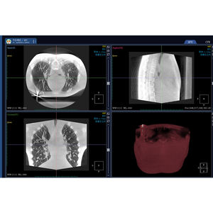 เครื่องตรวจเอกซเรย์เอกซ์เรย์ WICT-460เครื่องตรวจเอกซเรย์คอมพิวเตอร์เครื่องตรวจเอกซเรย์คอมพิวเตอร์เครื่องตรวจสัตว์แพทย์ CT - Product Image 3