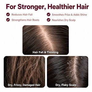 Kit de Cuidado Capilar de Cebolla Roja para el Cuero Cabelludo con Picazón, <span class=keywords><strong>Tratamiento</strong></span> Natural de Marca Privada, el <span class=keywords><strong>Mejor</strong></span> para el Crecimiento y Anticaída del <span class=keywords><strong>Cabello</strong></span>, Champú y Acondicionador - Product Image 3
