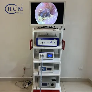 Ureterorenoscope laringoskop otoskop omurga Gastroenterology dijital ekran rektoskop HD SD CCD tıbbi endoskop kamera
