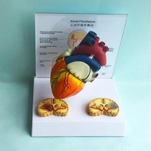 Modelo Anatómico de Fibrilación Atrial con Secciones Transversales de Corazón y Cerebro para la Enseñanza de Cardiología - Product Image 5
