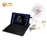 Scanner de sonde à ultrasons linéaire Doppler USB Compatible Android/Windows, prix d'usine avec ordinateur portable