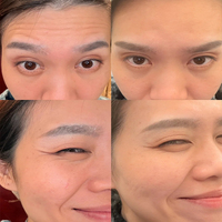 Ensemble de soins de la peau liquide anti-âge de luxe à la glycérine et à l'acide hyaluronique, raffermissant, éclaircissant, correcteur de pigmentation pour le visage