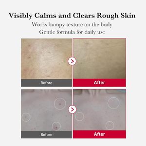 Medicube Red <span class=keywords><strong>Body</strong></span> Peeling Shot 110g Produk Perawatan Kulit Korea Perawatan Tubuh AHA + BHA Semprotan Pengelupas Kulit Perawatan Pori-pori - Product Image 4