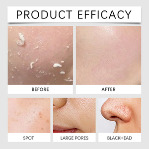 Crème pour le visage à la glycérine et au collagène pour <span class=keywords><strong>homme</strong></span> en marque propre, hydratation intense et réparation de la peau pour lutter contre le vieillissement et réduire les taches brunes - Product Image 5