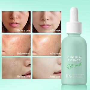 Sérum pour la peau à la Centella Asiatica, atténue les ridules et les rides, hydratant, éclaircissant, anti-âge, sérum pour le visage - Product Image 4