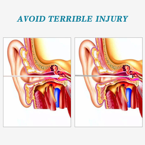 1080P HD Visual Herramienta de eliminación de cerumen Cámara de otoscopio inalámbrica con 6 luces LED Limpiador de oídos seguro - Product Image 6