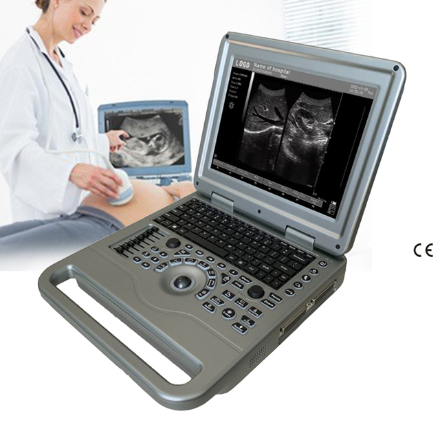 Precise Visualization Lowest Price Ultrasound Machine SUN-806A Made in China Cost-Effective for General Clinics