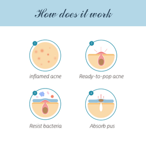 Nhà máy sản xuất giá Hydrocolloid Bìa mụn mụn vá sản phẩm bán chạy nhất cho khuôn mặt - Product Image 3