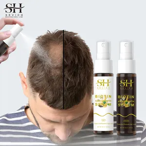 Lotion pour la croissance des cheveux Huile pour la croissance des cheveux personnalisée Fabricant Spray pour le traitement des cheveux au collagène et à la biotine