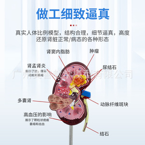 Simulation pédagogique de la structure et de l'anatomie du rein humain ; organes internes malades ; urologie ; glomerules ; néfons - Product Image 2