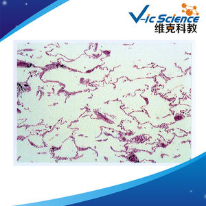 Patologie-Objektträger Lehrmittel <span class=keywords><strong>Tumor</strong></span>-Experimentierausrüstung und Artikel Professionelle Hersteller Patologie-Objektträger - Product Image 6