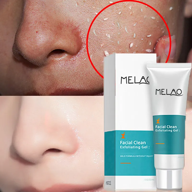 Melao-Exfoliante para el cuerpo de la cara, Exfoliante orgánico hidratante, Gel Exfoliante Facial blanqueador de Aloe Vera