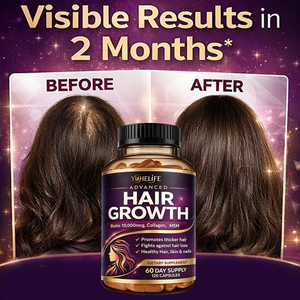 Capsule per <span class=keywords><strong>la</strong></span> Salute di Pelle, Capelli e Unghie all'Ingrosso, Capsule di Collagene per <span class=keywords><strong>la</strong></span> Crescita dei Capelli, Capsule di Biotina per <span class=keywords><strong>la</strong></span> Crescita dei Capelli - Product Image 4