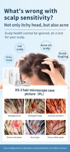 Dispositivo Analizador de Cuero Cabelludo con IA, USB, para Entrenamiento en Academias, Máquina de Análisis de Cabello y Cuero Cabelludo con Computadora - Product Image 6