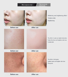 SICAPU 5D Nourish Pro เครื่องพ่นสเปรย์เพื่อความงาม ควบคุมด้วยหน้าจอสัมผัส การส่งสารอาหารแบบไม่ทำร้ายผิวหน้า การดูแลหน้าและหนังศีรษะ - Product Image 3