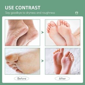 Venta directa de fábrica Etiqueta privada <span class=keywords><strong>40</strong></span>% <span class=keywords><strong>Urea</strong></span> Cuidado DE LOS PIES Aceite de árbol de té <span class=keywords><strong>Crema</strong></span> para pies Reparación Hidratante Peel Talones agrietados - Product Image 6