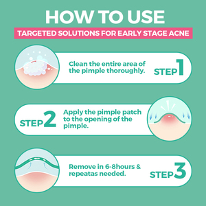 แผ่นแปะสิวไฮโดรคอลลอยด์สำหรับใบหน้า ยี่ห้อส่วนตัว แผ่นแปะสิวแบบใสสำหรับหน้าผาก - Product Image 5