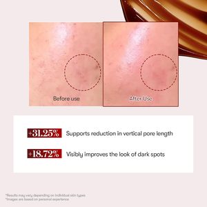 Siero Viso Red Booster Reedle Shot 100 da 50ml per Pelli Sensibili con Formula all'Acido Ialuronico - Rivitalizzante Cutaneo - Product Image 4