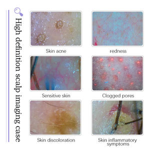 Tendencia 2025: Tratamiento Facial Aqua Peeling 14 en 1, Lifting Facial, Eliminación de Puntos Negros, Limpieza Facial, Belleza para Salón - Product Image 3