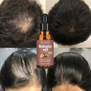 Olio Essenziale <span class=keywords><strong>di</strong></span> Rosmarino Naturale e Biologico con Logo Personalizzato, Siero Nutriente per Cuoio Capelluto e Capelli, Olio <span class=keywords><strong>di</strong></span> Batana per la Crescita dei Capelli - Product Image 1