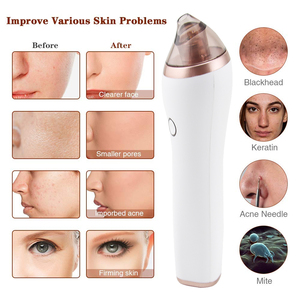 Extracteur de points noirs, nettoyeur de pores du nez, aspirateur à points noirs, appareil de suppression des points noirs avec caméra - Product Image 3