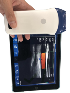 Sonda de Ultrassom Portátil Sem Fio com Array Linear, Imagem Colorida Doppler, Grau Clínico - Product Image 3