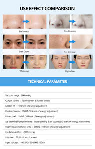 Máquina de Hidrodermoabrasión Aqua Peel 7 en 1 Portátil y Ecológica para Aclarar el Tono de la Piel, Minimizar los Poros y Cuidado de la Piel - Product Image 2