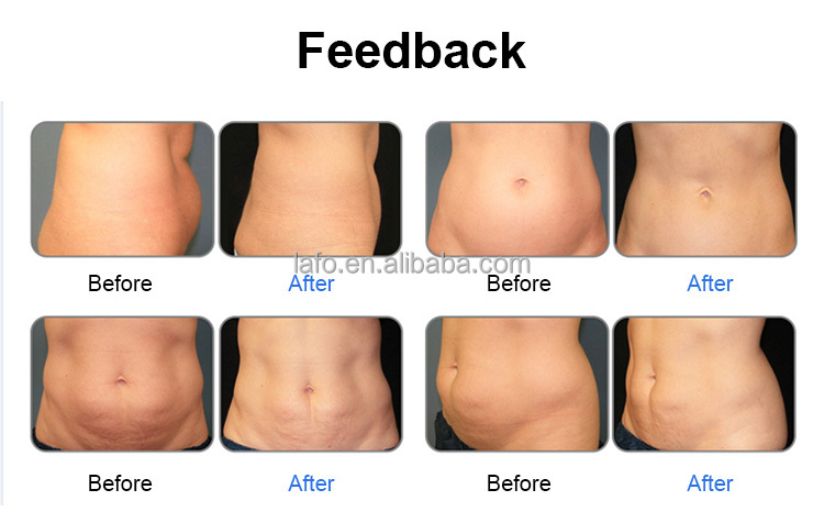 Hot sale 6D Laser Body Shape System 635nm wavelength lipolaser of cold laser Slimming Machine Reduce Fat