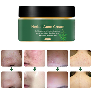 Krim Perawatan Bekas Jerawat <span class=keywords><strong>Herbal</strong></span> Organik Terbaik Label Pribadi - Product Image 4