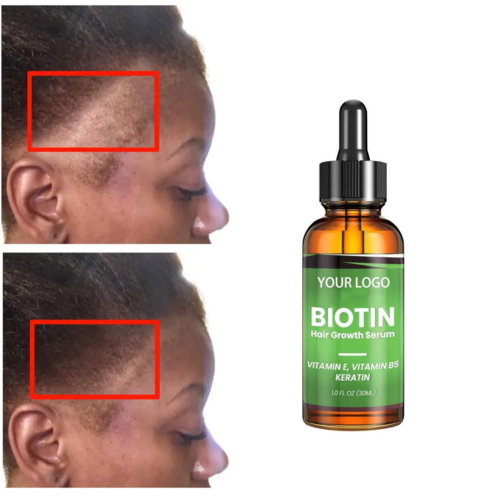 Private Label Vitamin B5 Keratin Formel Großhandel Pflegende Kopfhaut Elixiere Haarpflege Verlust Behandlung Haarwuchs öl Serum