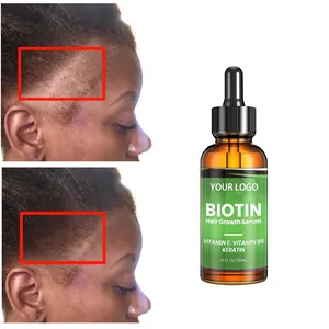 Fórmula de queratina con vitamina B5 de Etiqueta Privada, tratamiento nutritivo para la pérdida del cabello, aceite para el crecimiento del cabello, suero nutritivo para el cuero cabelludo