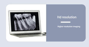 Buisrunyes Draagbare Tandheelkundige Röntgenmachine Met Digitaal Xray Sensor Beeldvormingssysteem - Product Image 5