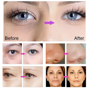 Électroporation portable pour blanchir la peau, favoriser la circulation lymphatique, rétrécir les pores, blanchir et raffermir la peau, salon de beauté - Product Image 5