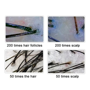Detector Profesional de Folículos Capilares, 10MP, Lente Dual, Dispositivo Analizador de Piel para la Pérdida de Cabello, Cuero Cabelludo Graso, Inspección <span class=keywords><strong>Facial</strong></span> de la Piel - Product Image 6