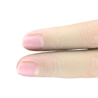 Doigt Prothétique Cosmétique en Silicone Naturel JZ Personnalisé, Élasticité Réglable, Respirant, Confortable, Taille Universelle
